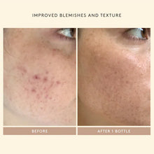 Load image into Gallery viewer, Shani Darden Skin Care Retinol Reform® Treatment Serum