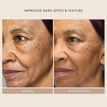Load image into Gallery viewer, Shani Darden Skin Care Retinol Reform® Treatment Serum
