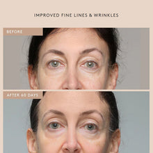 Load image into Gallery viewer, Shani Darden Skin Care Retinol Reform® Treatment Serum