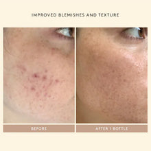 Load image into Gallery viewer, Shani Darden Skin Care Retinol Reform® Treatment Serum

