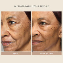 Load image into Gallery viewer, Shani Darden Skin Care Retinol Reform® Treatment Serum
